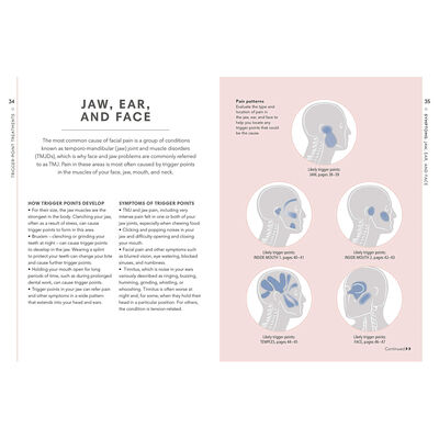 Trigger Points image number 4